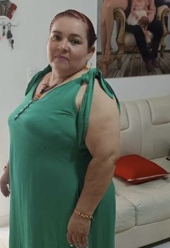 testimonio-3-1 Testimonio Cirugia Bariátrica | Antes y Después