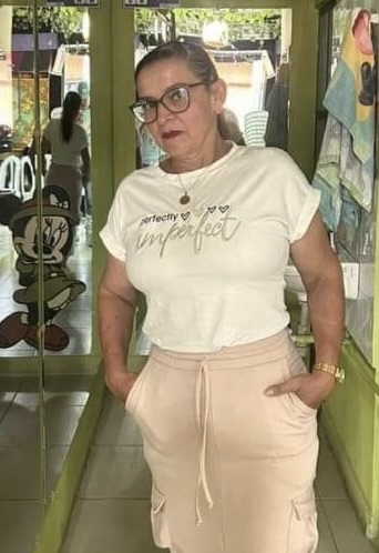 Testimonio Cirugia Bariátrica | Antes y Después